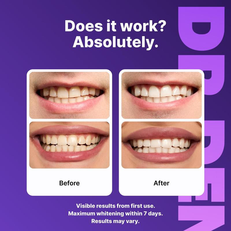 Experience a Brighter Smile with DR.DENT Purple Teeth Whitening Strips - 7 or 21 Sessions of Safe, Enamel-Friendly Whitening for Sensitive Teeth