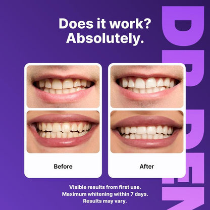 Experience a Brighter Smile with DR.DENT Purple Teeth Whitening Strips - 7 or 21 Sessions of Safe, Enamel-Friendly Whitening for Sensitive Teeth